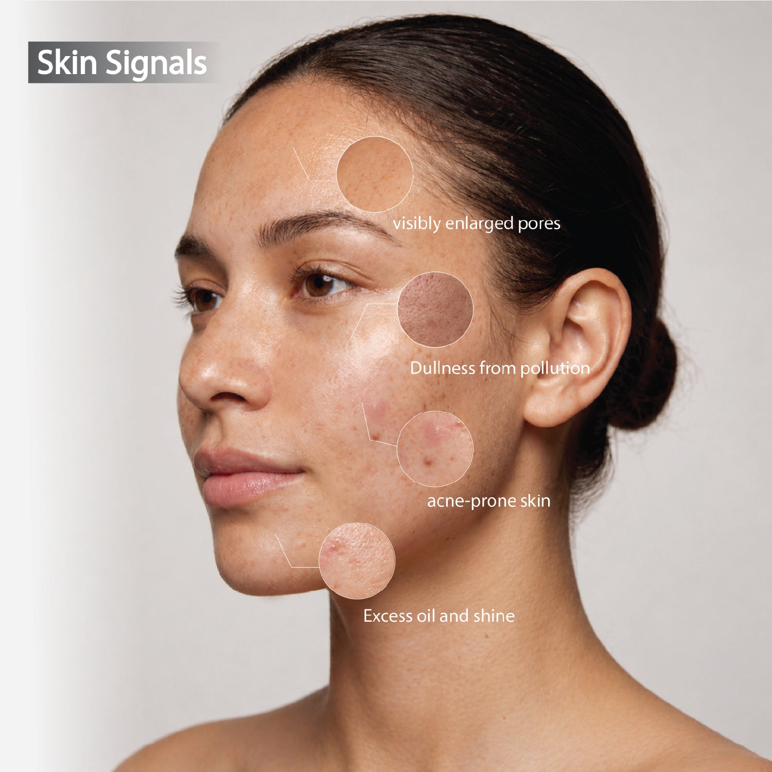 Detox: Acne, Oil & Pollution Control Face Wash